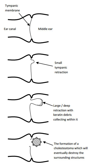 a drawing of the middle ear