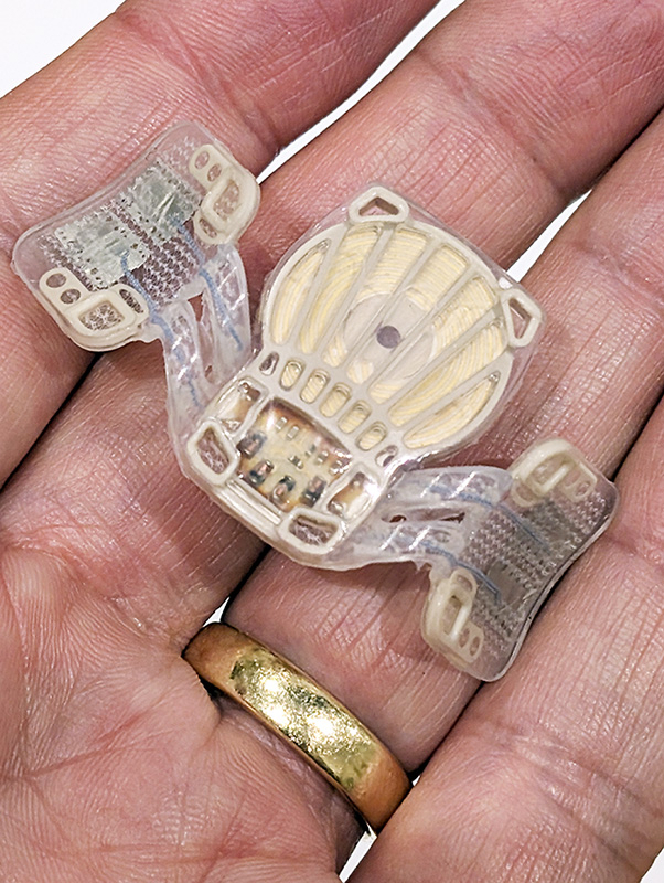 A Nyxoah genio implant in my hand