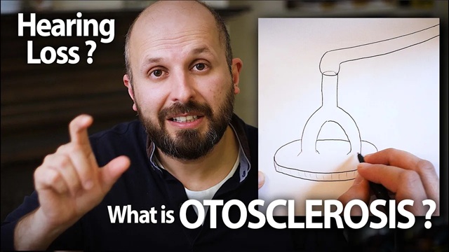 Professor Vik Veer discusses how to treat ear Otosclerosis and Stapedectomy