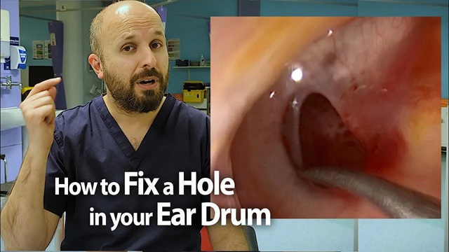 Professor Vik Veer discusses how to treat ear hole tympanic perforation holes